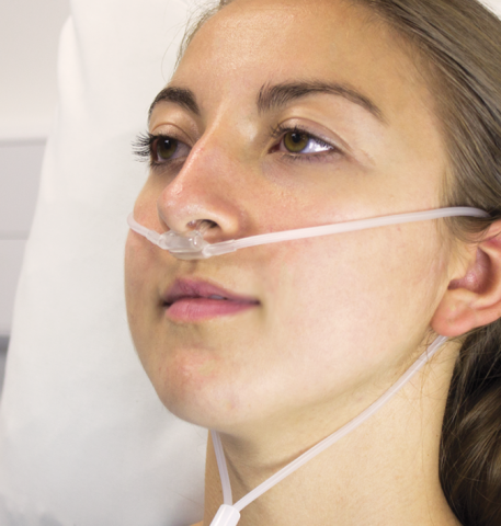 ETCO2 Nasal Cannula
